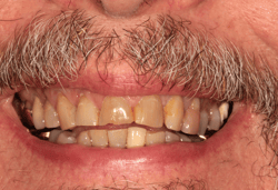 Before Dental Treatment